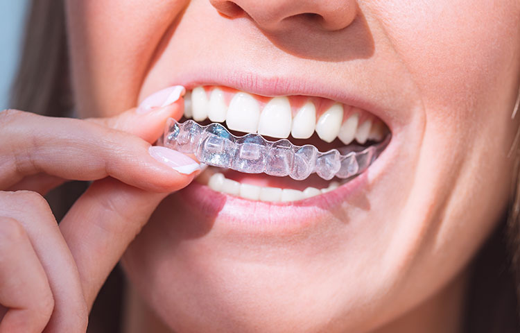 当院の矯正治療