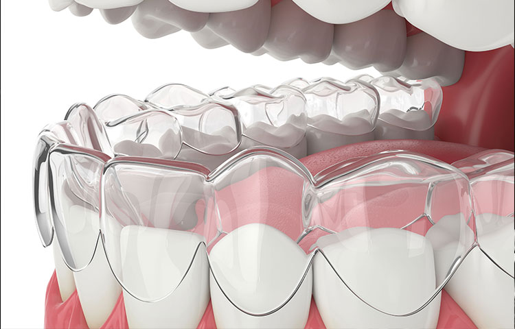 当院の矯正治療
