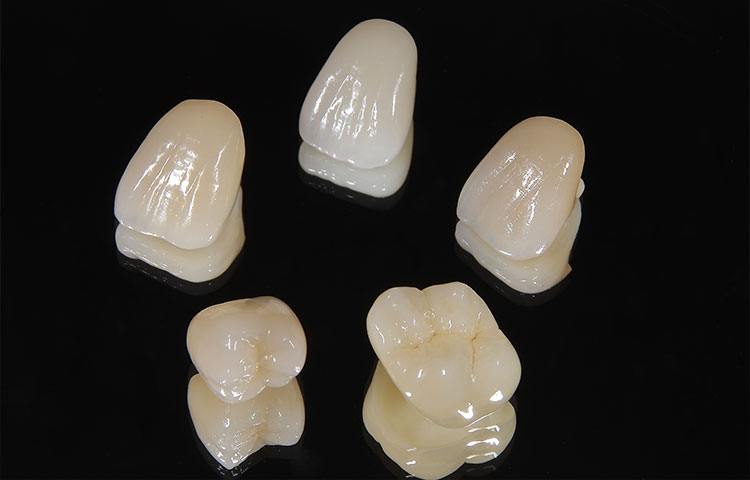 セラミック治療