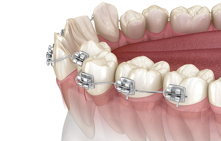 当院の矯正治療