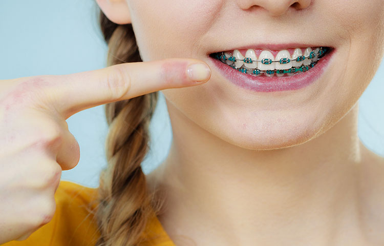 当院の矯正治療