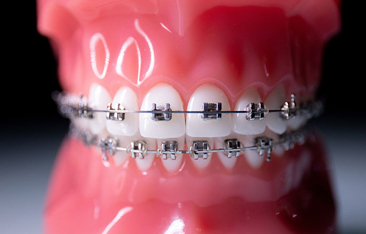 当院の矯正治療