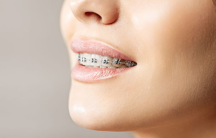 当院の矯正治療