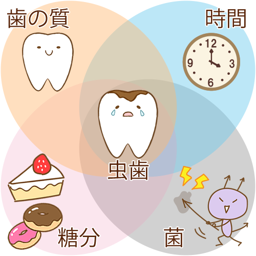虫歯予防と砂糖の関係 - うえさか歯科（箕面市、桜井駅、歯科医院