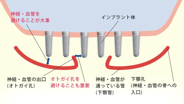 アナトミー2: もう一度確認したいインプラント臨床のための解剖