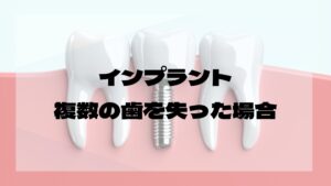 複数インプラント