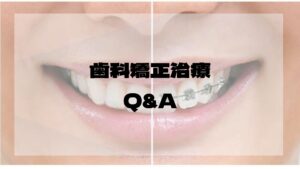 矯正治療よくある質問