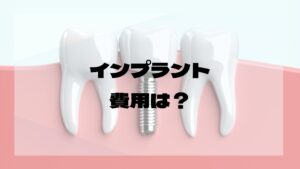 インプラント費用