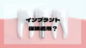 インプラント保険適用