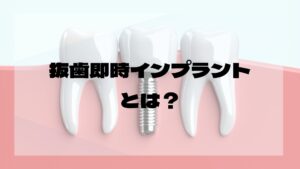 抜歯即時インプラント