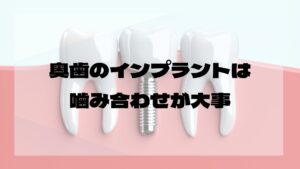 奥歯のインプラント