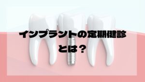 インプラントの定期検診