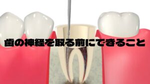 歯の神経を取る前に