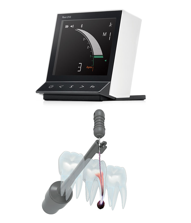 高周波モジュール付き根管長測定装置 Root ZX3