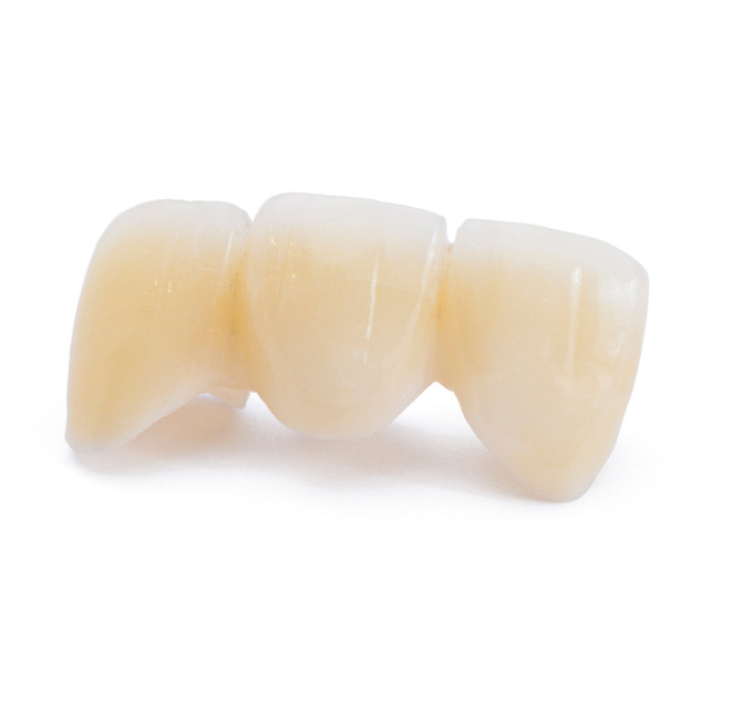 メタルフリー治療とは？