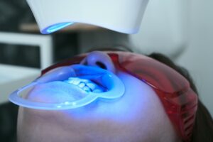 ホワイトニング