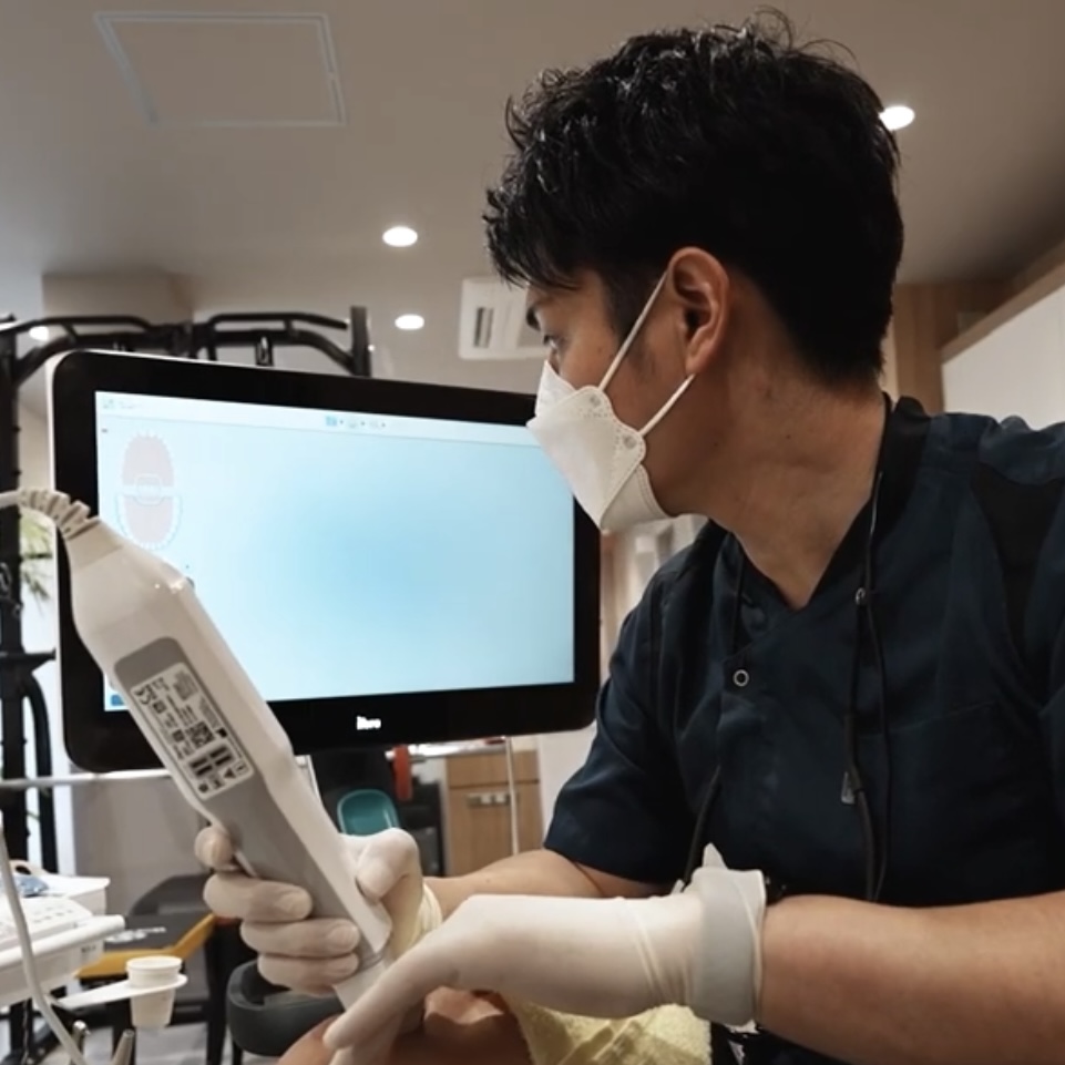 口腔内スキャナー Itero