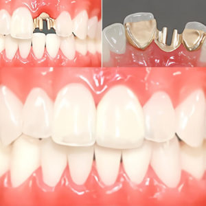 ヒューマンブリッジ