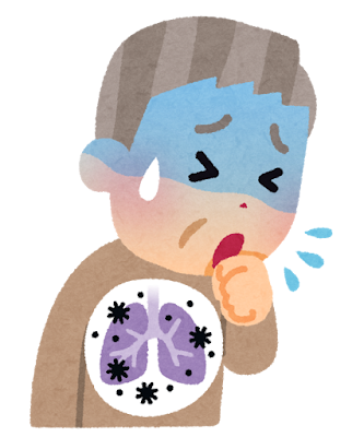 誤嚥性肺炎のイラスト
