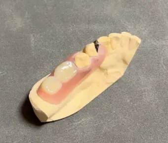 ミラクルデンチャー